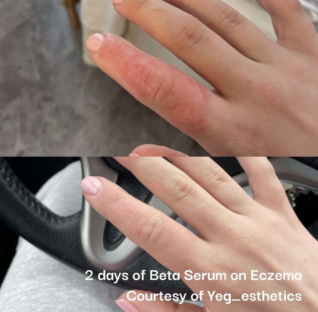 NeoGenesis Beta-Glucan Serum